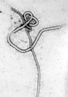 Ebola virus